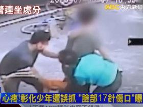 17歲少年遭警誤抓害縫17針「左臉如被利刃切開」…呂秋遠聲援：願免費幫他提告，不能就這樣算了